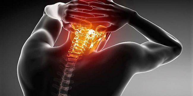 cervicalgia-dor-na-cervical
