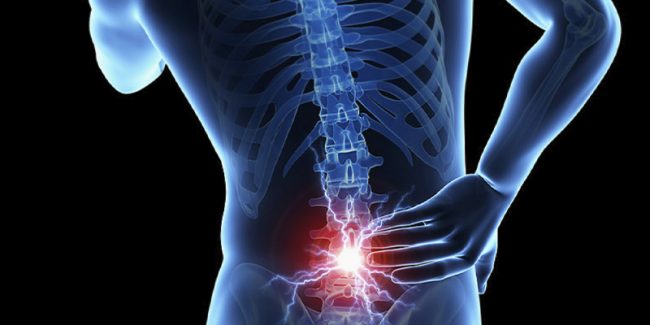 dor-no-coccix-coccidinia