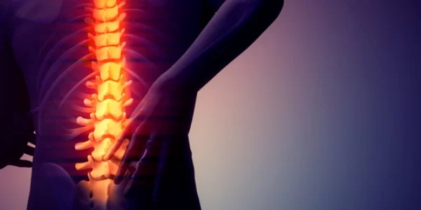 espondilite-anquilosante-o-que-e-causas-diagnostico-e-tratamento
