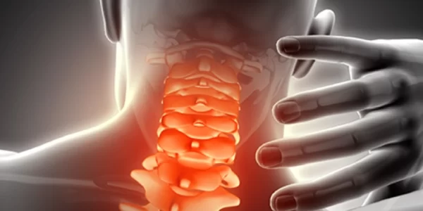 Espondilose-o-que-é-sintomas-tratamentos-e-causas