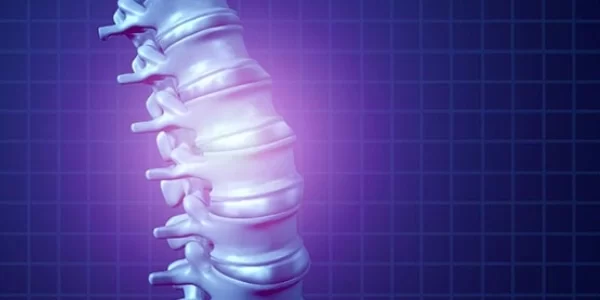 Nódulo-e-Schmorl-o-que-é-sintomas-e-tratamentos-adotados