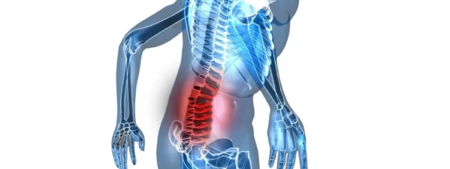 espondiloartrose-o-que-e-diagnostico-prevencao-e-tratamentos