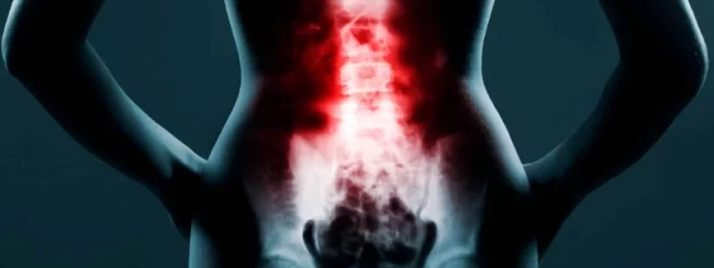 cisto-sinovial-na-coluna