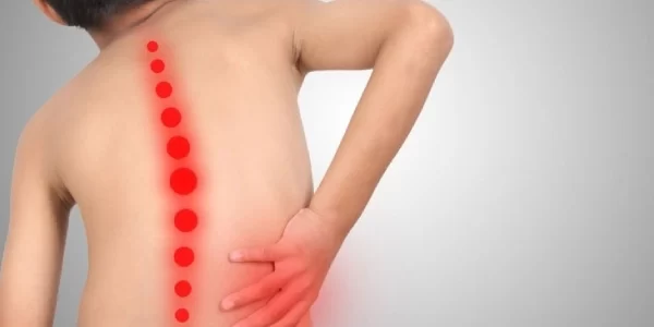 Escoliose idiopática