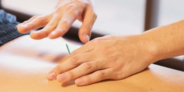 acupuntura para coluna